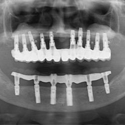 Clínica Dental Doctora Sánchez Pérez radiografía dental